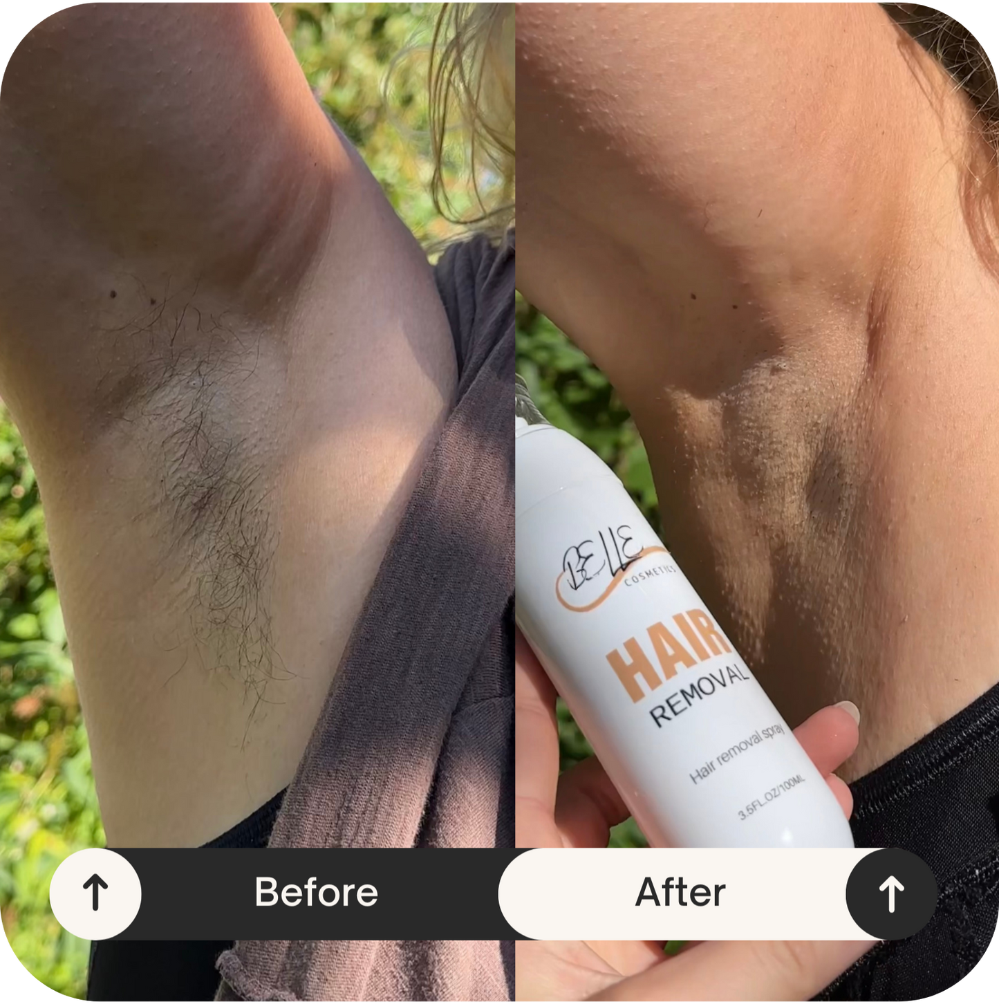 Hair Removal Spray
